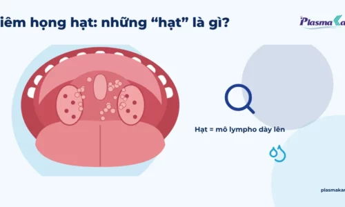 Minh họa khoang miệng nhìn thẳng khi há miệng, thành sau họng có nhiều nốt hạt nhỏ màu hồng
