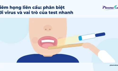 Minh họa nửa dưới khuôn mặt, miệng há nhẹ, bàn tay cầm cây đè lưỡi gỗ và chiếc đèn soi nhỏ, màu sắc dịu, không thấy mắt